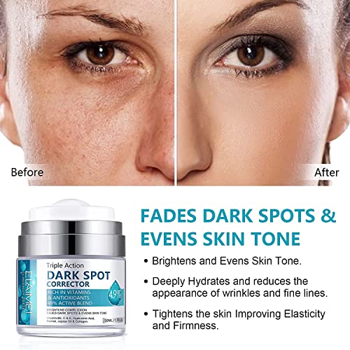 Dark Spot Remover Cream for Face & Body 50ml, Dark Spot Corrector with Arbutin and Niacinamide, Prevent Forming Dark Spots, Fade Spots, Reduces H