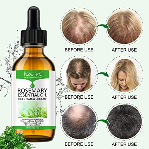 Rosemary Essential Oil for Hair Growth & Skin Care, Improve Hair Loss and Nourishes Scalp for Men and Women, Rosemary Oil for Hair Growth, Hair G