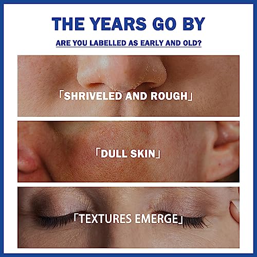 Face Moisturiser, 10% Niacinamide Serum+ 1% Zinc Serum, High-Strength Vitamin to Control Excess Oil and Redness, Tackles Blemishes, Minimises Por