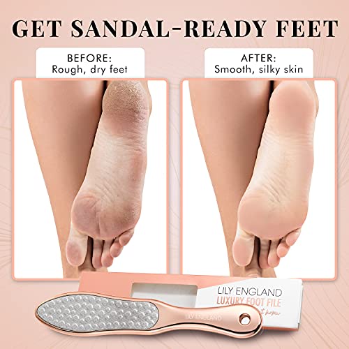 Foot File for Hard Skin Remover - 2-in-1 Professional Footfile and Dry Skin Remover for Feet, Stainless Steel Pedicure Tool by Lily England, Rose