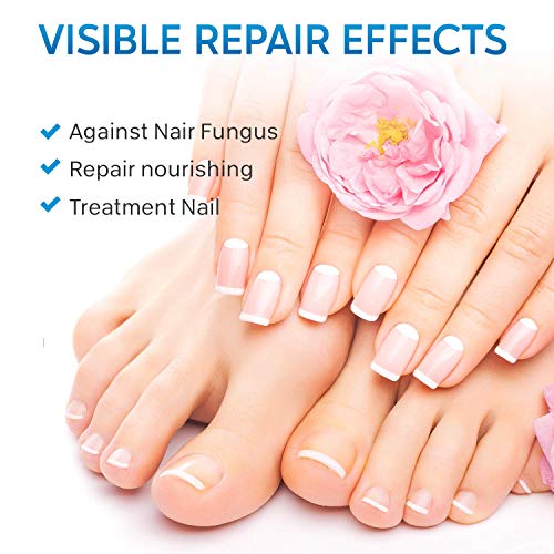 Fungal Nail Treatment, Fungus Nail Cream, Strong Anti-Fungal Toenail Cream, Nail Repair Nourishing Treatment, Restores Discolored and Damaged Nai