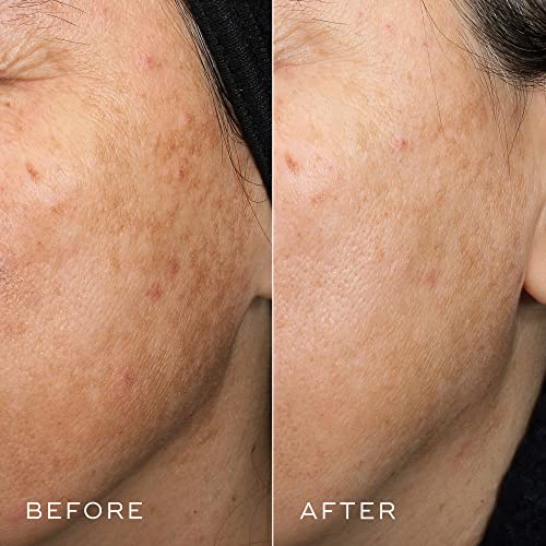 Medik8 Crystal Retinal 1 - Anti Ageing Retinol Cream for Radiant Skin - 30ml