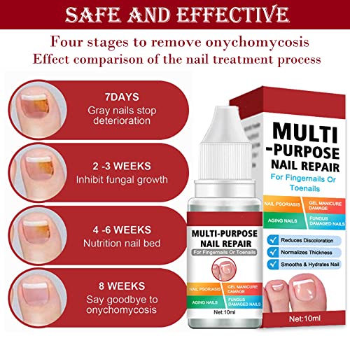 Fungal Nail Treatment for Toenail Extra Strong, Multi-purpose Nail Repair for Fingernails Toenails, Toe Nail Fungal Treatment Fungal Nail Solutio