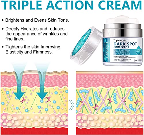 Dark Spot Remover Cream for Face & Body 50ml, Dark Spot Corrector with Arbutin and Niacinamide, Prevent Forming Dark Spots, Fade Spots, Reduces H