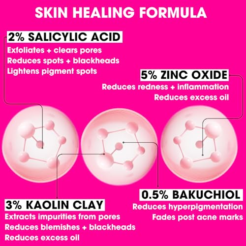 Clear Skin Days Blemish Treatment Cream - Overnight Spot & Acne Treatment for Face - with Salicylic Acid & Zinc - Calm Aggravated Skin, Treat Ble