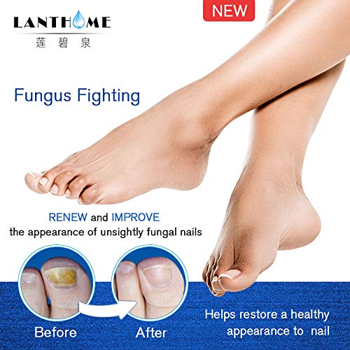 Nail Fungal Treatment for Toenails, Fungus Stop,Anti fungal Nail Solution Repairs & Protects from Discoloration,Fungal Nail Treatment,Restores na