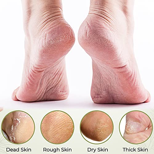 Eruinfang, Double Sided Wooden Foot Rasp File Foot Scraper Hard Skin Remover Foot Files for Wet Dry Cracked Feet Removing Dead Skin Foot Care, Bl