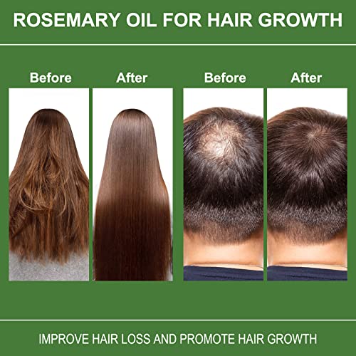 Rosemary Oil For Hair Growth 120ml, Rosemary Oil Pure Organic, Improve Hair Loss & Promote Hair Growth, Rosemary Hair Oil For Men Women