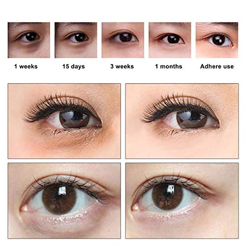 GNAPY 24K Gold Eye Treatment Mask Under Eye Patches Anti Aging Anti Wrinkle Eye Patches Moisturizing Mask for Puffy, Eyes Dark Circles, Hydrating