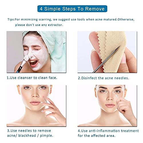 4PCS Blackhead removal tool kit. Four-piece with storage box for nose facial care silver