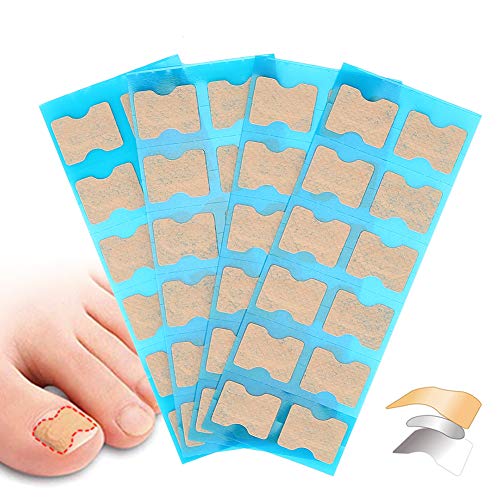 Ingrown Toenail Stick Patch, 4 Sizes Glue-free Toe Nail Correction File Patch Paronychia Corrector Foot Care Treatment Pedicure Tool Ingrown Toen