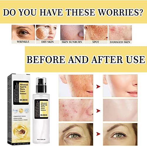 Fullcube Advanced Snail 96 Mucin Power Essence -Snail Secretion Filtrate 96% Revitalize and Moisturize with Reduce Wrinkles and Irritation,Skin R