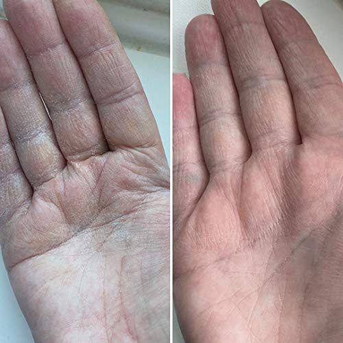 Nursem FRAGRANCE FREE HAND CREAM β 75ml | Fast-absorbing, natural hand cream cruelty free for sensitive skin