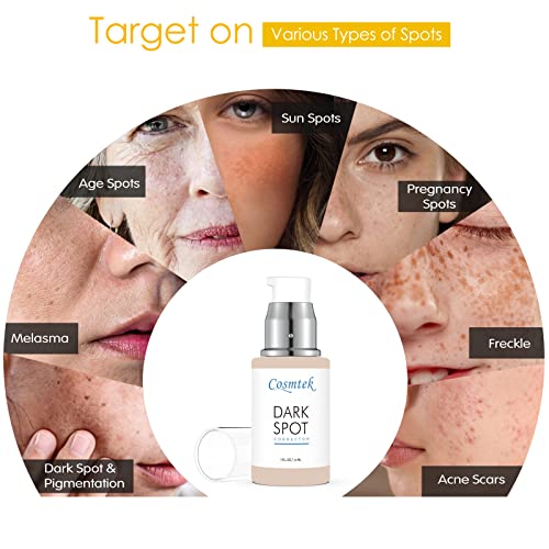 Dark Spot Remover for Face and Body, Age Spot, Sun Spots and Melasma Freckle Remover, Hyperpigmentation Treatment, Liver Spot Corrector, Formulat