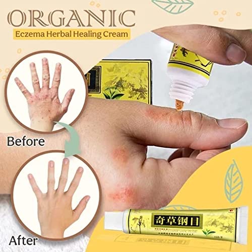 HOPASRISEE Natural Chinese Herbal Cream, Organic Eczema Herbal Healing Cream, Face Cream, Body Cream, Anti-Itch Cream Ointment External Use (12pc