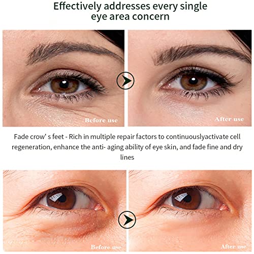 Somnr Anti Ageing Eye Cream for Lines and Wrinkles and Dark Circles, Powerful Under Eye Cream Moisturiser Revitalising Eye Roll On, 20g