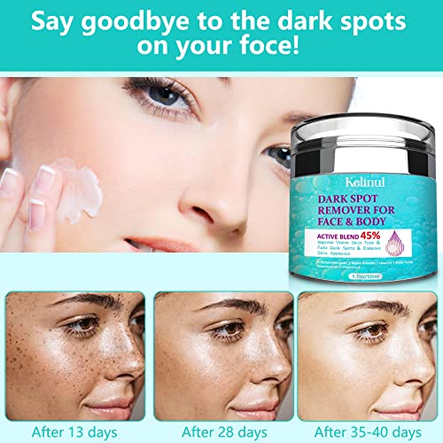 Dark Spot Remover for Face Dark Spot Corrector and Remover for use on face, body, or sensitive intimate areas, treat dark spots, age spots, or su