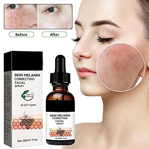 Dark Spots Correcting Facial Serum,Brightening Facial Serum,Rapid Dark Spot Correcting Serum,Improve Dry Skin & Smooth Skin,Brightening Serum,Dar