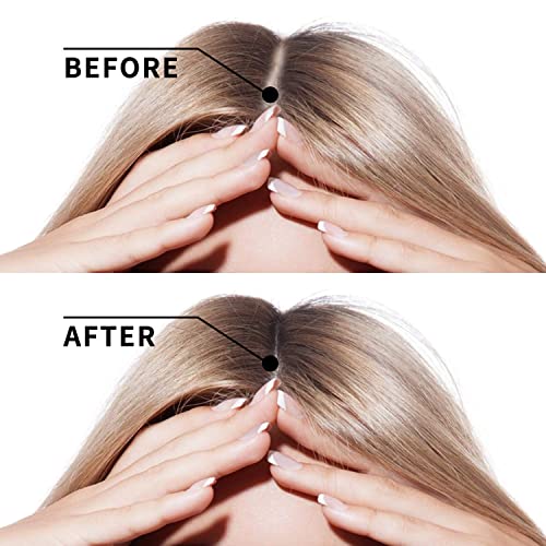 Hair Growth Serum vitamins serum for Hair Loss and Hair Regrowth Ginger Hair Growth Oil for Thinning/Balding/Repairs Hair Follicles/Stronger Hair