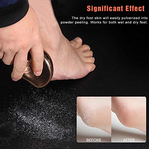 BEZOX 2in1 Nano Glass Foot File for Foot Spa, Home Salon -Highly Effective Callus Remover Wake Up Velvety Feet -High-Density Fine Nano Glass Not