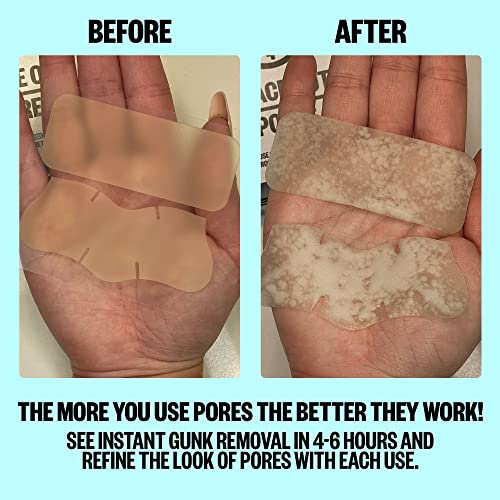 Peace Out Skincare Pores. Hydrocolloid Pore-Refining Nose and Face Strips with Vitamin A to Shrink Enlarged Pores and Remove Excess Oil (4 pore a