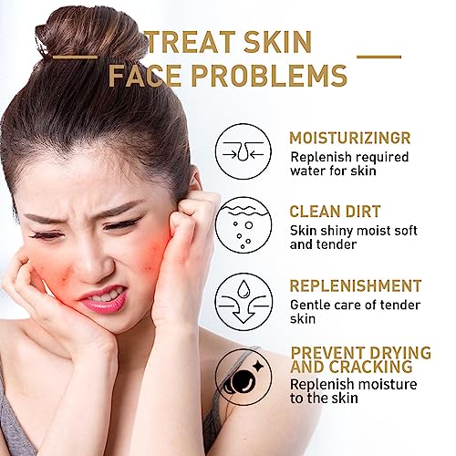 Rice Face Toner - 5.28fl oz Glow Boosting Essence, Rice Toner for Face, Natural Moisturizer Glow Essence, Hydrating and Moisturizing Rice Extract