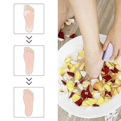 6PCS Pumice Stone for Feet, Foot Care Tool Kit, Pumice Stone for Hard Skin, Ideal Foot Scrub Stone and Exfoliator Block, Purple
