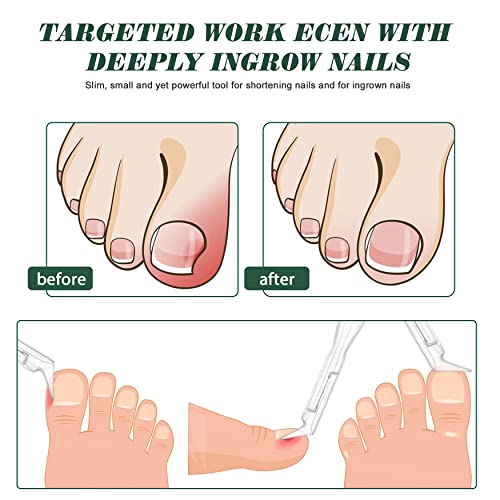 FVION Toenail Clipper Straight Blade, Professional Toe Nail Clipper for Senior, Ingrown Toenail Tool for Thick Ingrown Nails