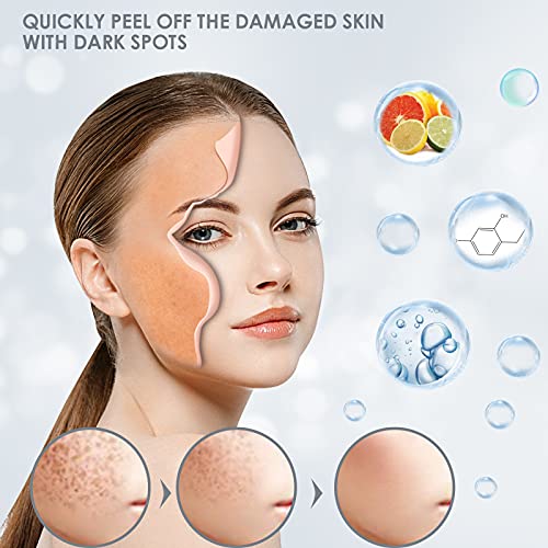 Dark Spot Remover for Face and Body, Age Spot, Sun Spots and Melasma Freckle Remover, Hyperpigmentation Treatment, Liver Spot Corrector, Formulat