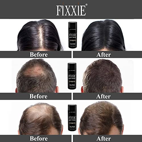 FIXXIE Hair Fibres MEDIUM BROWN for Thinning Hair 27.5g Bottle, Hair Fibre Concealer for Hair Loss for Men and Women, Naturally Thicker Looking H