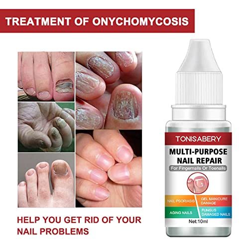 Fungal Nail Treatment,Nail Fungus Treatment For Toenail,Toe Nail Fungal Treatment,Toenail Fungus Treatment,Fungal Nail Treatment For Toenails Ext