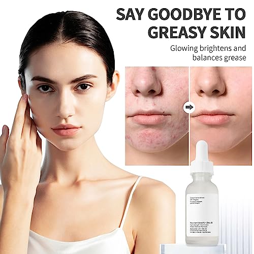 Niacinamide10%+Zinc 1%,Tackles Blemishes, Pore Reducer Face Serum,Minimises Pore, Brightening Serum for Blemish-Prone,Dull Skin, Softens & Bright