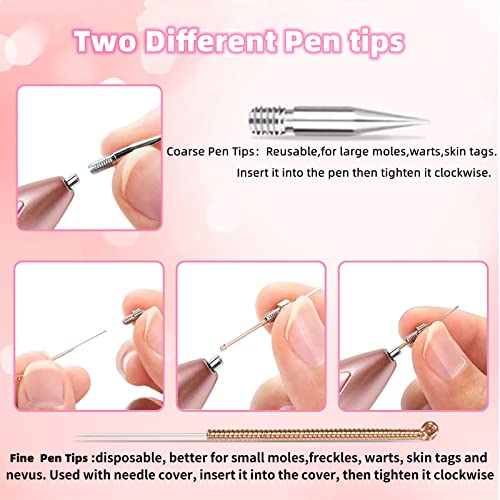 CHRERNA Skin Tag Pen Remover Kit, Mole Pen Removal Kit with 9 Strength Levels &Replaceable Accessories, Plasma Pen for Freckle, Age Spots,Nevus (