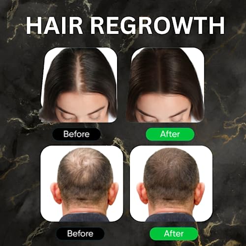 Pre Diluted Rosemary Oil For Hair Growth Natural Serum, with Biotin, Sunflower Oil, Argan Oil and Rosemary Oil Natural Hair Growth Oil with Pre D