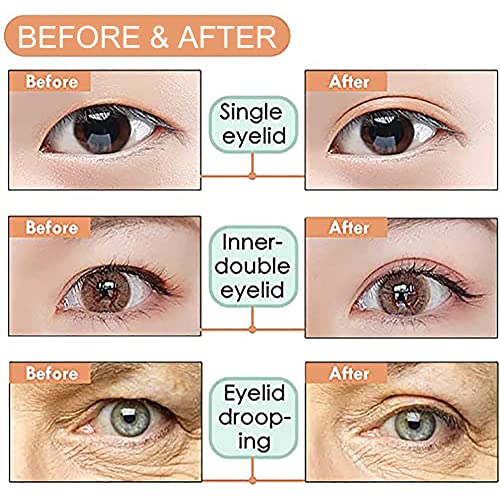 Eyelid Lift Strips,Invisible Eyelid Strips,Invisible Eyelid Strips,Eye Lids Strips,Double Eyelid Tape,Eye Tape,Eyelid Strips,Self-Adhesive Eye Ta