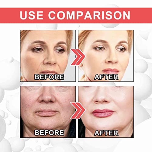 EELHOE Collagen Boost Anti Aging Serum, Anti-Aging Serum, Anti-Wrinkle Face Serum Fade Microgroove, Blemish Skin Corrector Serum, Dark Spot Corre