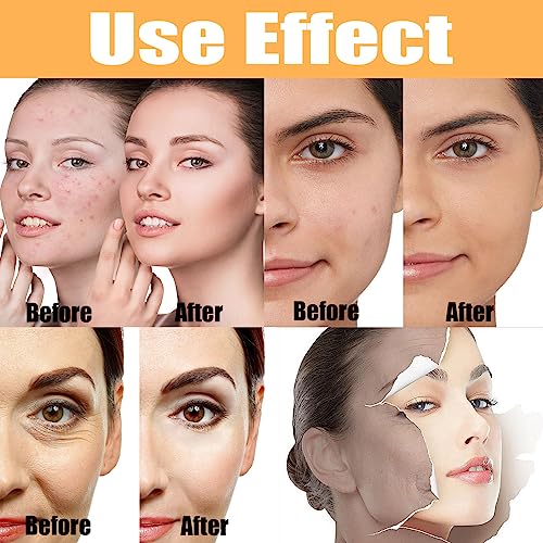 Glycolic Acid 7% Toning Solution,Glycolic Acid Toner,Repair Acne Skin Toner,Anti Aging Serum for Face,100ml Dark Spot Corrector Oil Face Serum fo