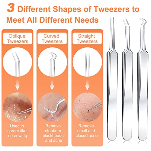 Blackhead Remover Tool Kit, IUMAKEVP 15 PCS Professional Stainless Steel Pimple Popper Comedone Extractor Tools for Removing Pimple, Blackheads,