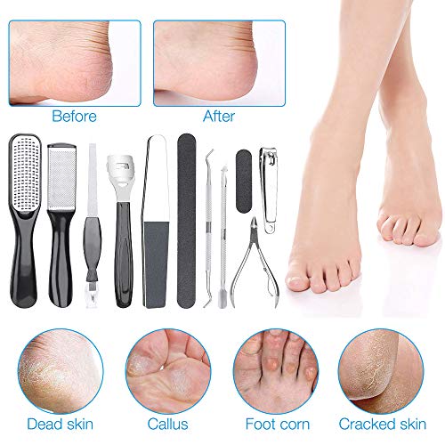 Professional Pedicure Kit, Gobesty Stainless Steel Foot File Pedicure and Manicure Set Pedicure Nail Clipper Hard Skin Remover Foot Care Kit for