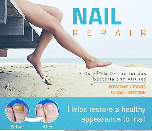 Nail Fungal Treatment for Toenails, Fungus Stop,Anti fungal Nail Solution Repairs & Protects from Discoloration,Fungal Nail Treatment,Restores na