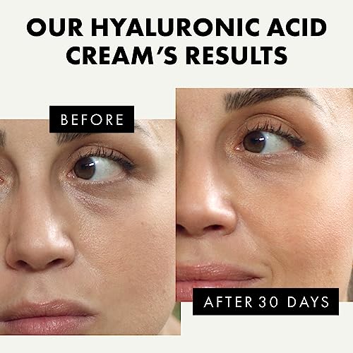 Organic Hyaluronic Acid Cream - 3X MORE POTENT 2% Hyaluronic Acid Moisturiser & Anti Ageing Cream + Retinol to Hydrate/Firm Day & Night - 100% VE