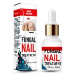 Fungal Nail Treatment for Toenails Extra Strong, Toenail Fungus Treatment Nail Repair for Fingernails Toenails, Toe Nail Fungal Treatment Fungal