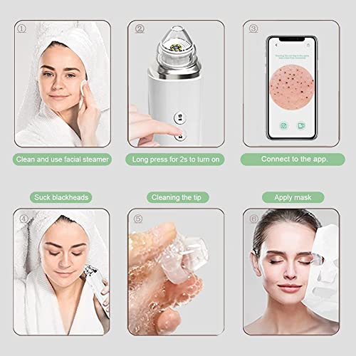 Blackhead Remover Pore Vacuum, Upgraded WIFI Visible Facial Pore Cleanser with HD Camera Pimple Acne Comedone Extractor Kit with 6 Suction Heads