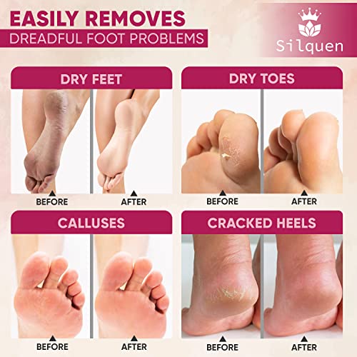 Silquen Professional Pedicure Foot Files for Hard Skin - Premium 3 in 1 Pedicure Foot File, Scrubber and Foot Scraper for Soft & Smooth Heels