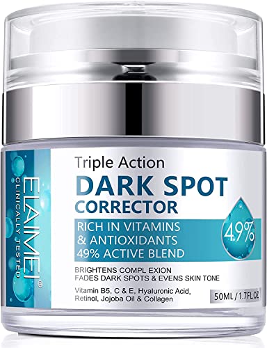 Dark Spot Remover Cream for Face & Body 50ml, Dark Spot Corrector with Arbutin and Niacinamide, Prevent Forming Dark Spots, Fade Spots, Reduces H