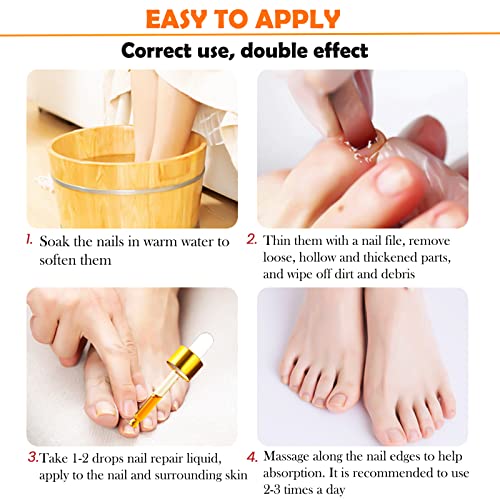 Fungal Nail Treatment for Toenails Extra Strong, Toenail Fungus Treatment Nail Repair for Fingernails Toenails, Toe Nail Fungal Treatment Fungal
