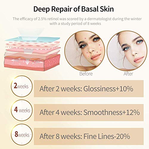 Retinol Serum,ETRONG High Strength Anti-aging Serum with 2.5% Retinol,Hyaluronic Acid and Vitamin E for Face Acne 1 Oz(30ml)