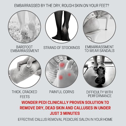 Callus Remover - Three Minutes Quick Fix- Foot File Rasp - Instant Foot Exfoliating Softener Peel Spray, Heels Callus Scrubber File - Home Spa Pe