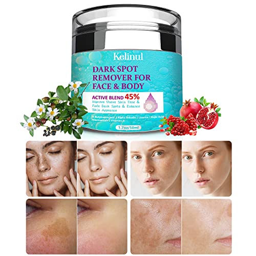 Dark Spot Remover for Face Dark Spot Corrector and Remover for use on face, body, or sensitive intimate areas, treat dark spots, age spots, or su