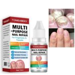 Fungal Nail Treatment,Nail Fungus Treatment For Toenail,Toe Nail Fungal Treatment,Ingrown Toenail Treatment,Toenail Fungus Treatment For Toenails